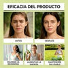 Image of Lymphatic Drainage Drops Herbal Liquid Lymph Support Wellness Tincture