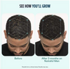 Image of Nutrafol Men Hair Growth Nutraceutical Dietary Supplement 120 Capsules